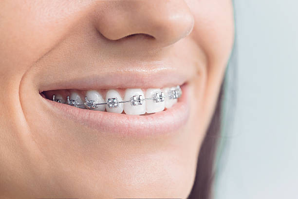 Best Veneers and Lumineers  in North Laurel, MD